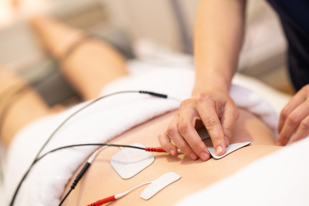 Elektrostimuliacija: kaip ji veikia ir kada gali būti taikoma? 